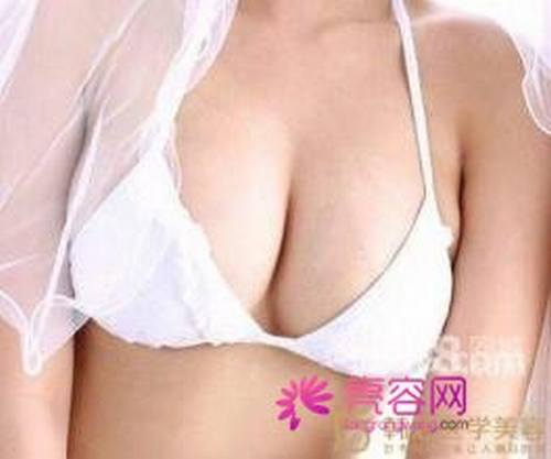 自体脂肪丰胸优点