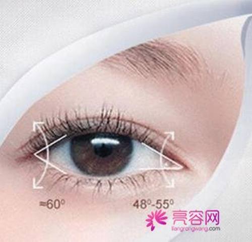 埋线双眼皮失败怎么办呢怎么样价格案例