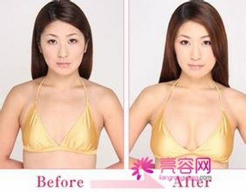 来聊聊女性都十分关注的话题:隆胸后是否可以哺乳!?