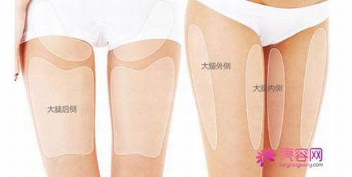 大象腿的福音!瘦!瘦!瘦!看看你的大腿够瘦吗?大腿吸脂!你怎么看?今天给各位讲解讲解腿部吸脂!
