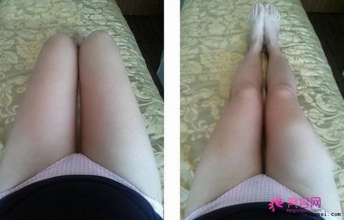 大象腿的福音!瘦!瘦!瘦!看看你的大腿够瘦吗?大腿吸脂!你怎么看?今天给各位讲解讲解腿部吸脂!
