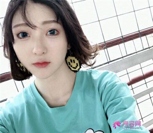 流量狗慎入!福利走一波!妹子术后真实案例分享!贵在真实!一大波美图来袭!