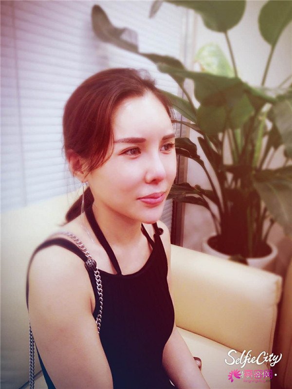 【鼻部手术】小仙女们,做完手术第一天就迫不及待想把自己这次的经历分享给大家了~~~