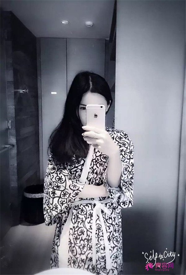 【鼻部手术】小仙女们,做完手术第一天就迫不及待想把自己这次的经历分享给大家了~~~