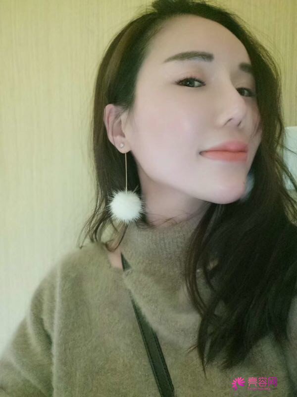 【鼻部手术】小仙女们,做完手术第一天就迫不及待想把自己这次的经历分享给大家了~~~