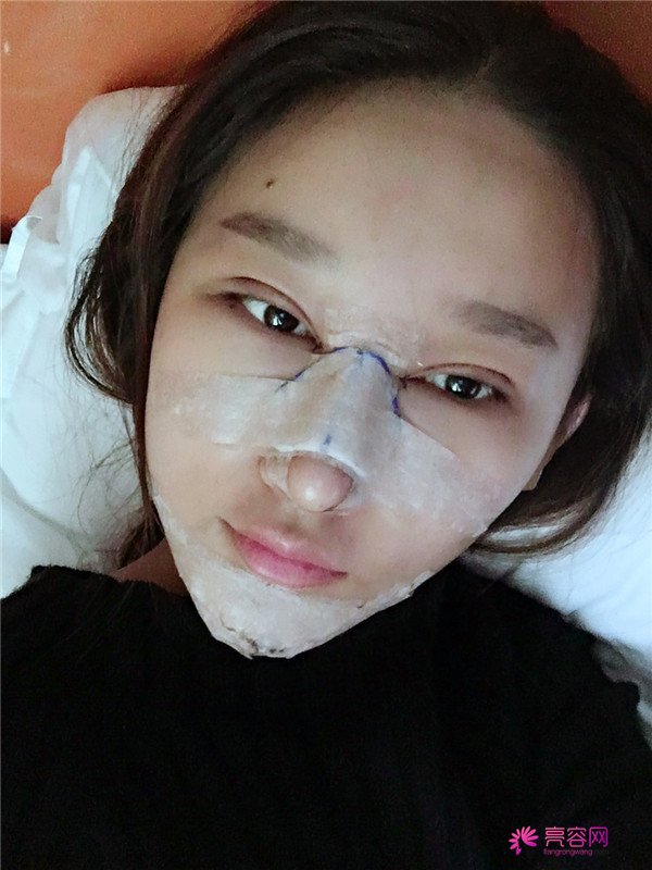 亲朋好友们都夸我变漂亮了,一条精致的线,就能够让眼睛瞬间变大、变亮、变漂亮!