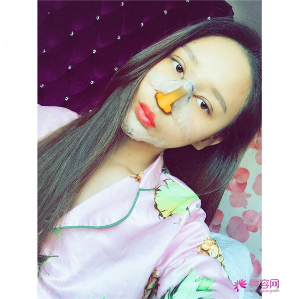 亲朋好友们都夸我变漂亮了,一条精致的线,就能够让眼睛瞬间变大、变亮、变漂亮!