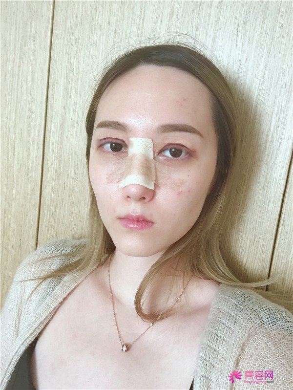 这个案例怎么样?不用我多说,你们一定会喜欢!话不多说?上图!么么哒!