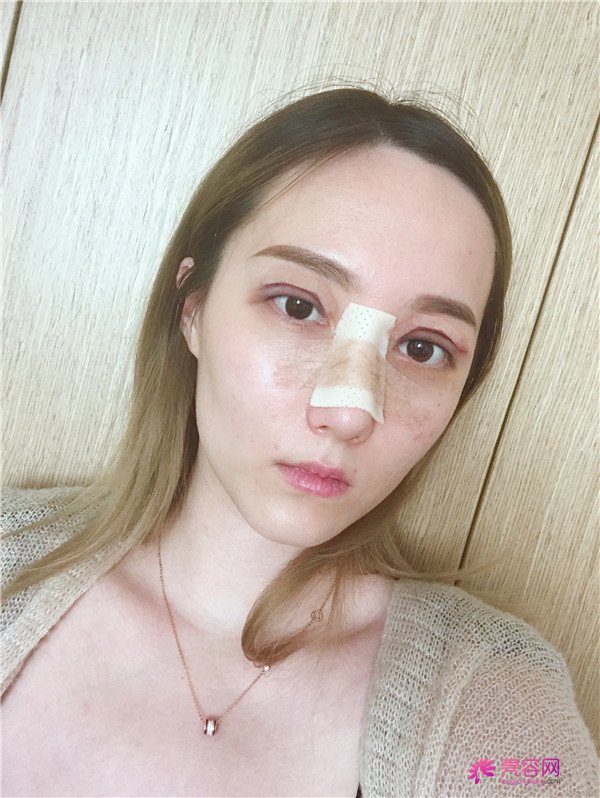 这个案例怎么样?不用我多说,你们一定会喜欢!话不多说?上图!么么哒!