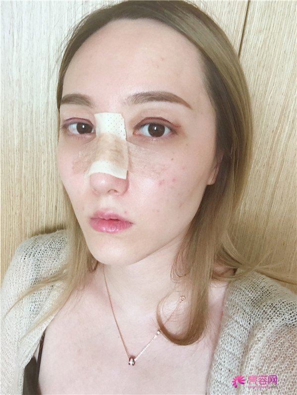 这个案例怎么样?不用我多说,你们一定会喜欢!话不多说?上图!么么哒!