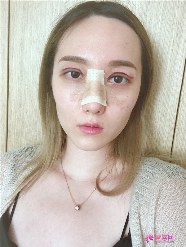 这个案例怎么样?不用我多说,你们一定会喜欢!话不多说?上图!么么哒!