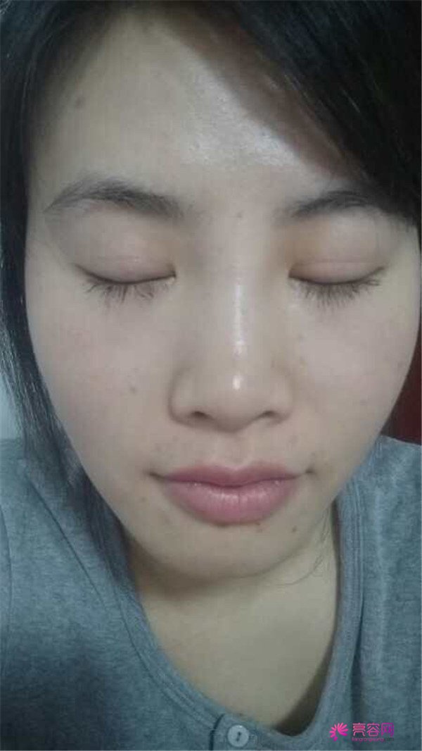 好羡慕那种不是太大宽眼皮的,小扇形的刘亦菲那种双眼皮,不过我现在也有啦~~哈哈