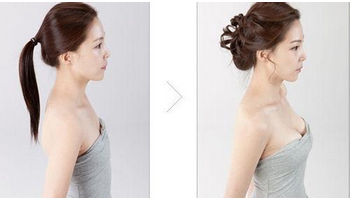 乳房下垂有那些危害?矫正有那些方法?