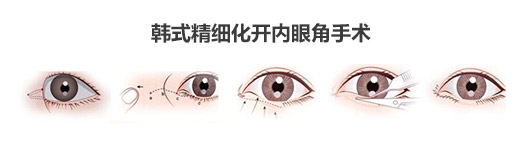 整形医院徐利刚双眼皮多少钱？好吗？