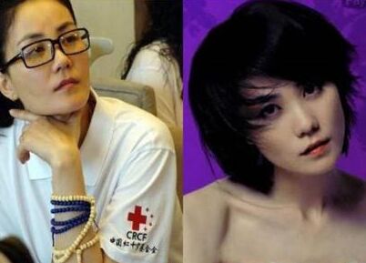 北京八大处王太玲做鼻子如何?