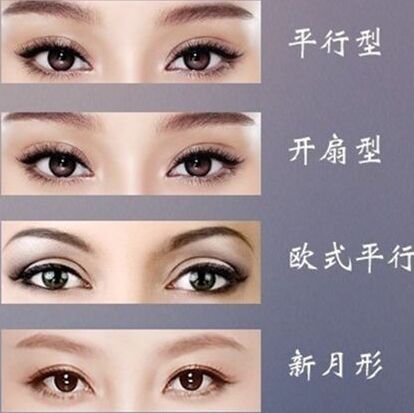 双眼皮形状 浙一范希玲和吴慧玲割双眼皮哪个好