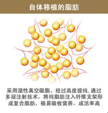 北京八大处陈兵自体脂肪填充技术怎么样?
