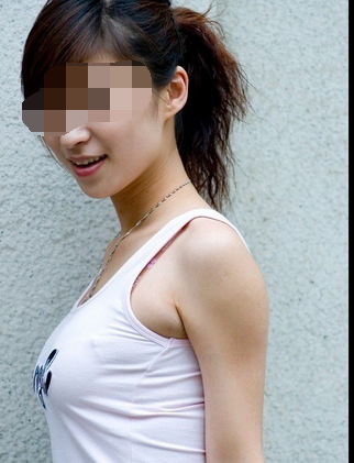 北京东方和谐张准隆胸技术怎么样?