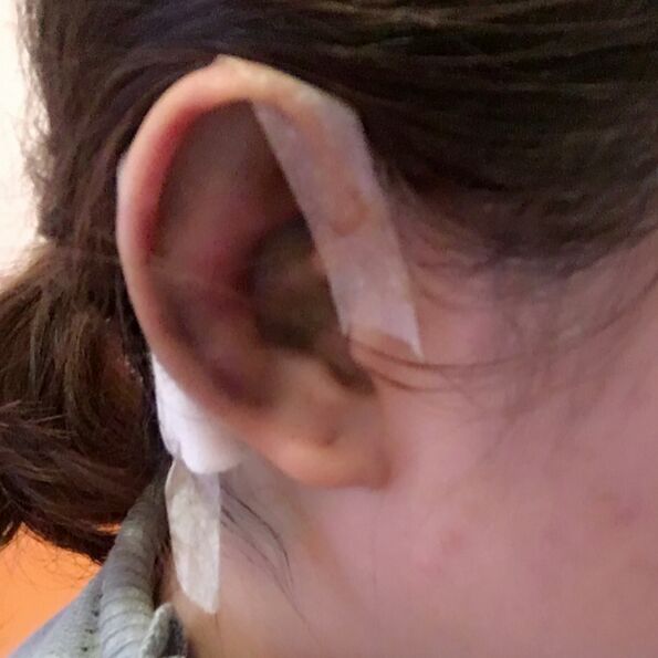 大家看看北京世纪坛医院徐光做的鼻子怎么样?