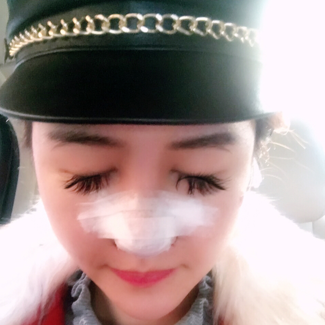大家看看北京世纪坛医院徐光做的鼻子怎么样?