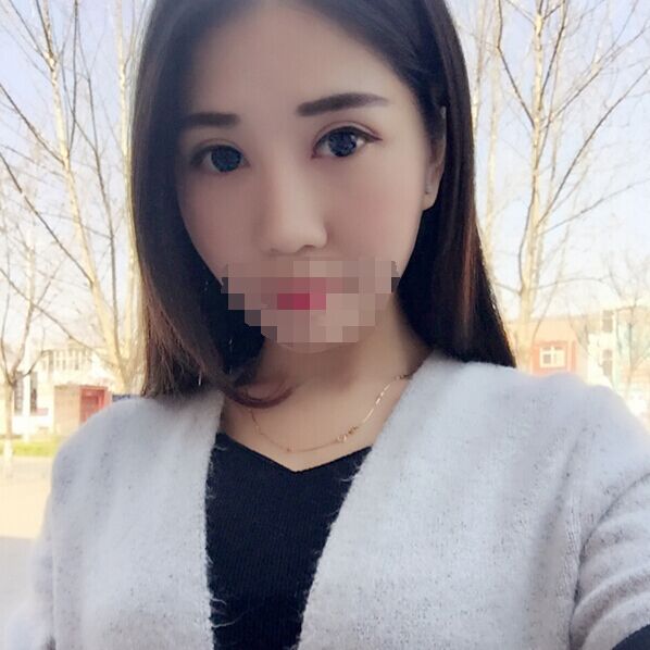 记录郑州孟明星双眼皮日记怎么样?