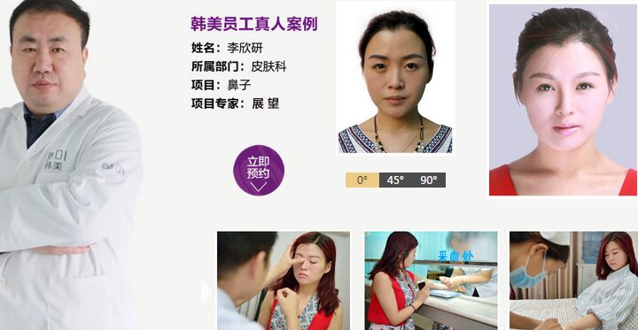 韩美展望隆鼻案例 济南韩美展望隆鼻做得怎么样?多少钱?