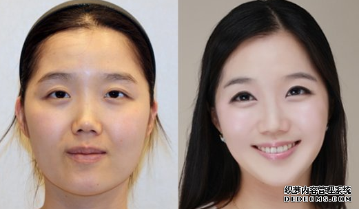 广州珠江柳大烈磨骨怎么样?