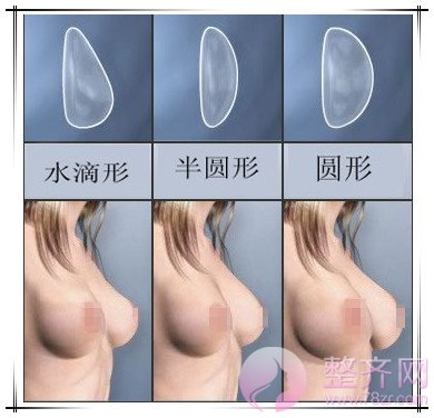 上海玫瑰整形医院张东旭隆胸怎么样?多少钱?