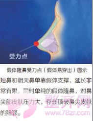 北京米扬丽格巫文云鼻部手术多少钱?有没有案例