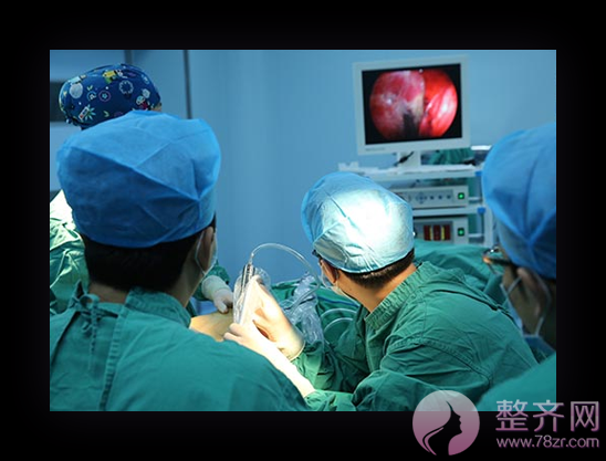 上海华美整形邓守成隆胸怎么样?有没有案例?