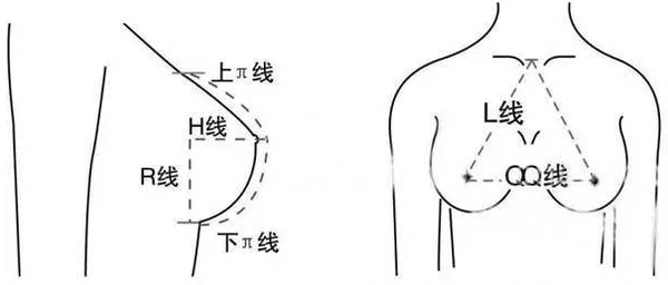 假体隆胸怎么去选择假体材料较好?