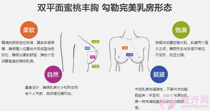 成都蜀尚蓉雅韩春隆胸怎么样?案例图?