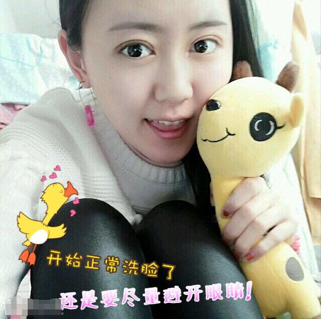 一单一双的双眼皮手术案例对比!