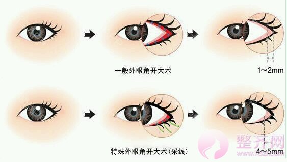 眼部知识我知道!!!