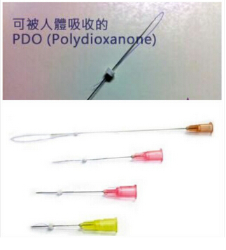 蛋白埋线提升都有什么区别吗?