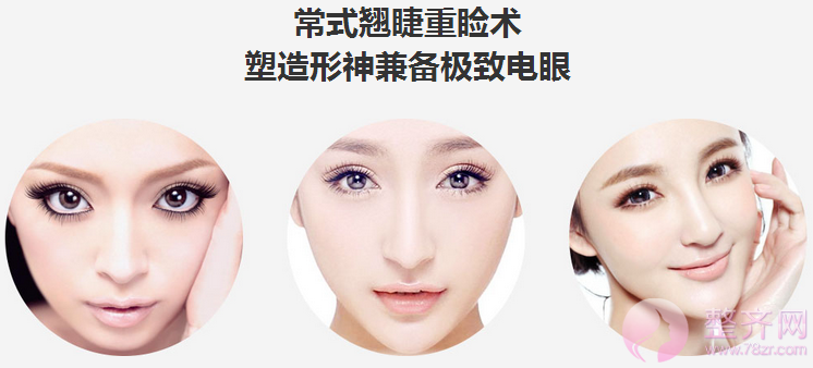 成都蜀尚蓉雅常小莉割双眼皮怎么样?案例图?