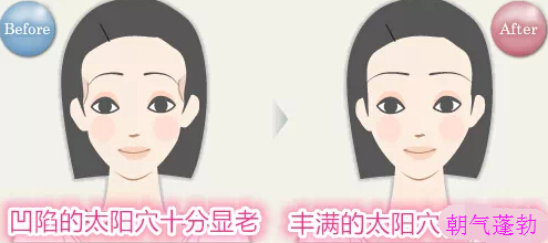 太阳穴凹陷该怎么办呢?
