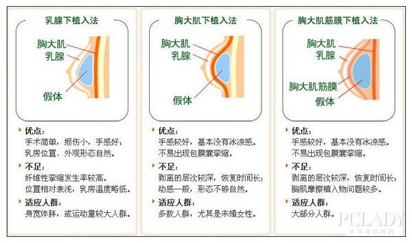 乳房切口入路选择有什么利弊?