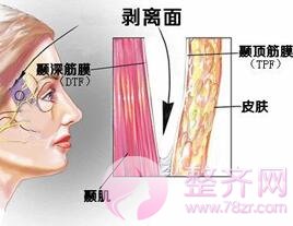 上海百达丽沈国雄隆鼻修复好不好?案例分析