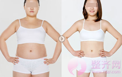 上海九院蒋朝华吸脂怎么样?多少钱?