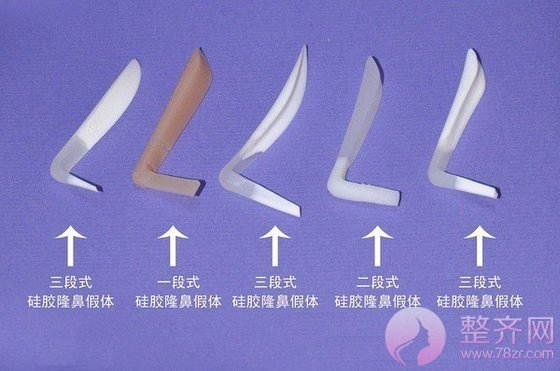 隆鼻有哪几种方法呢?