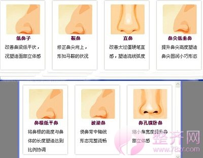 为什么做完隆鼻,还是不好看?