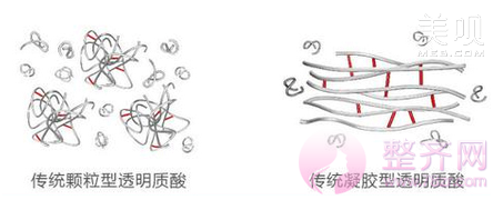 玻尿酸品牌这么多,到底应该怎么选?