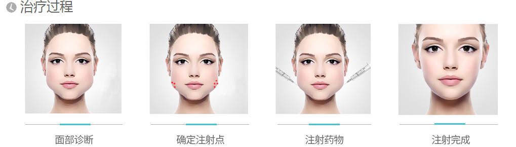 胶带贴一贴,双下巴就没了?整形医生惊呆了