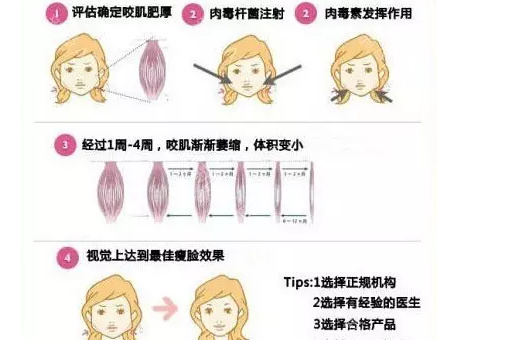 脸大打注射瘦脸就够了?“对阵下药”才有!