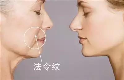 都知道大喜大悲容易产生皱纹,给你介绍方法