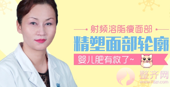 北京丹熙魏洁吸脂怎么样?魏洁面部吸脂案例?