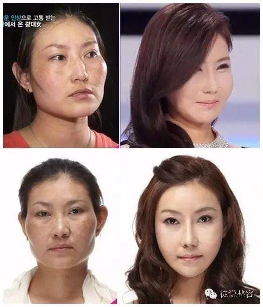 整容到底为了什么,请善待你整容的朋友!