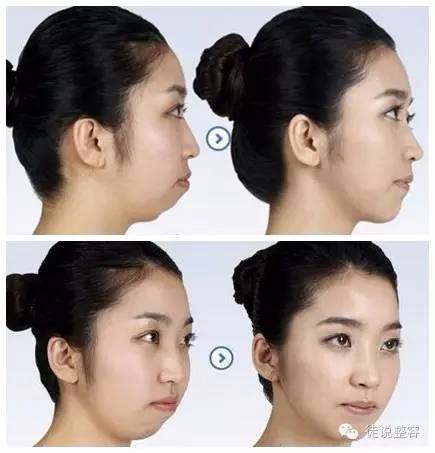 整容到底为了什么,请善待你整容的朋友!