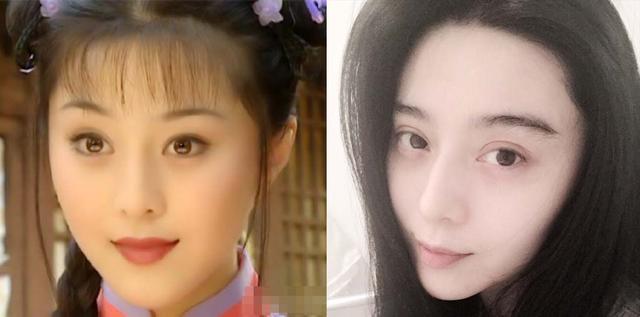 开眼角手术后留下明X疤痕,该怎么办?